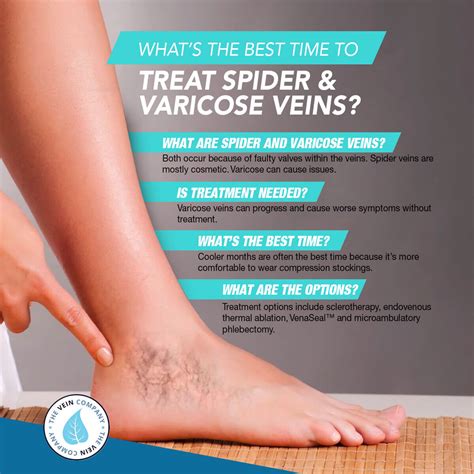 Spider Vein Treatment .